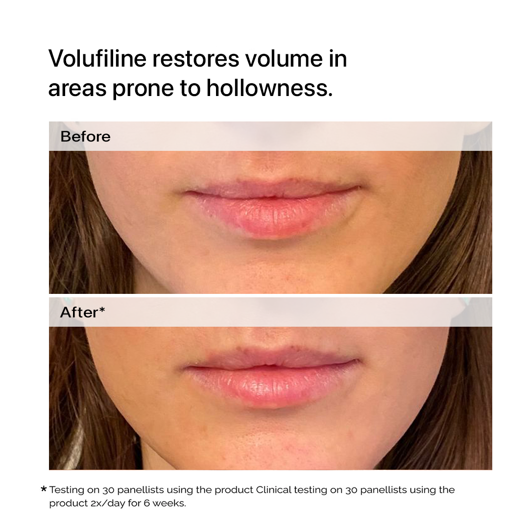 Volufiline 100%